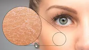 1 Certain way to Combat Dry Skin in the Winter.