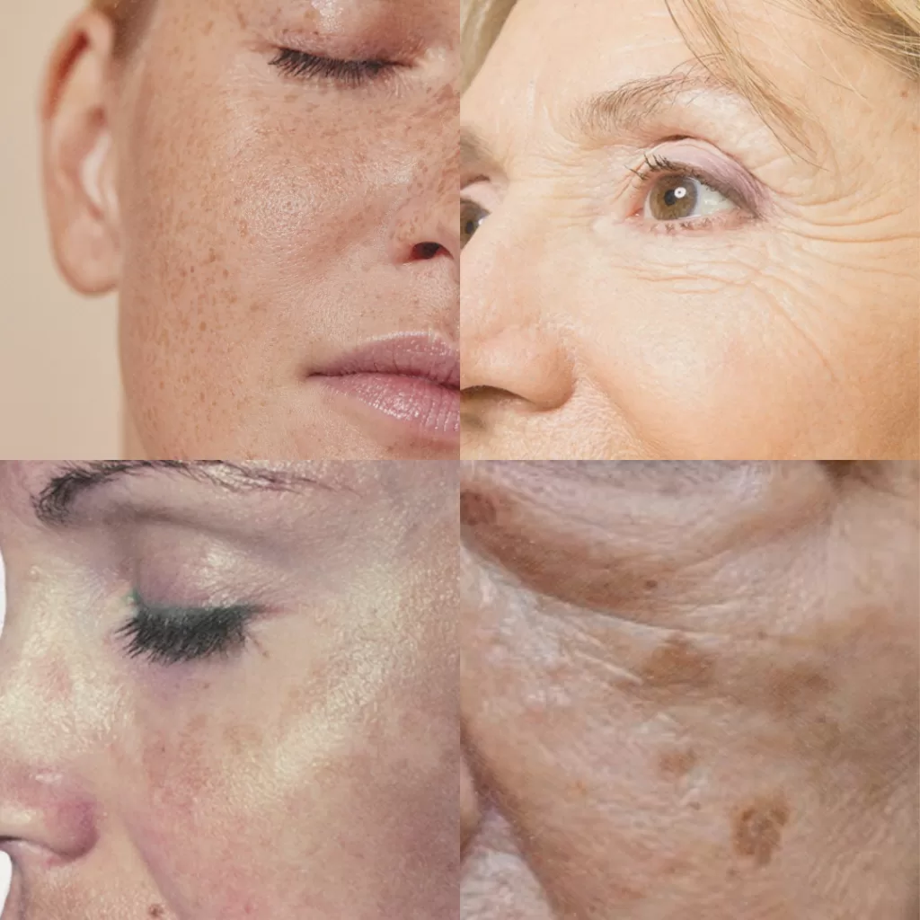 9 life-changing ways Vitamin C Serum Dimishes Age Spots. 1 Age Spots and Wrinkles